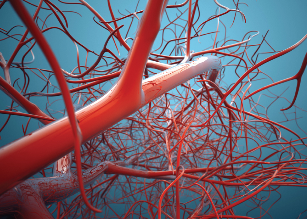 جراحة الأوعية الدموية