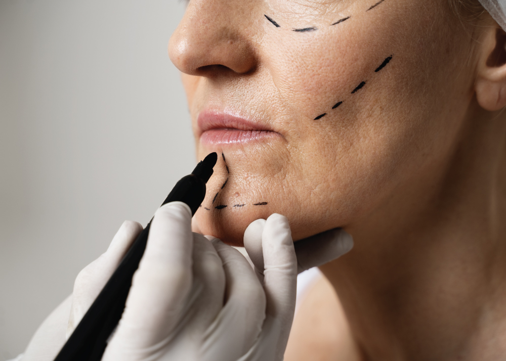 جراحة التجميل وإعادة الترميم