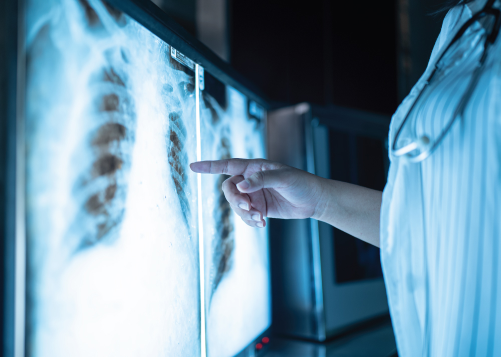 الأشعة التداخلية