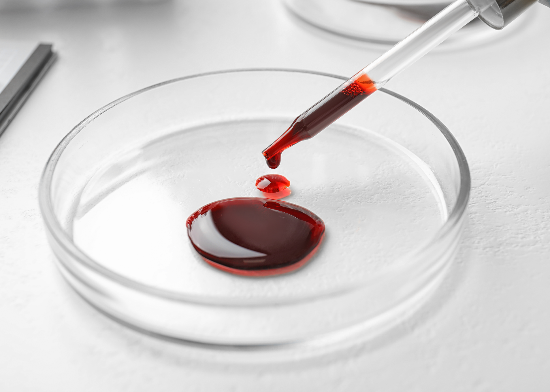 أمراض الدم والأورام