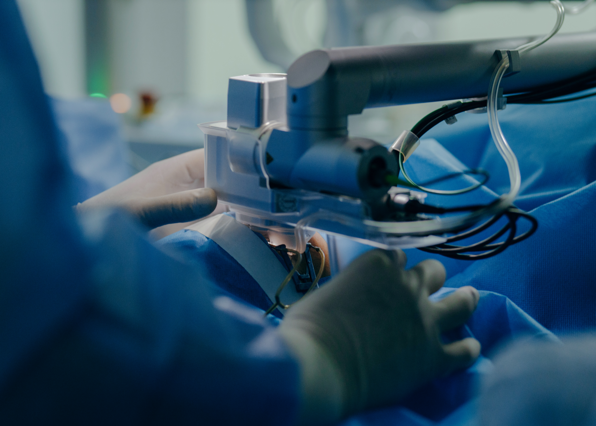 تطور جراحات أمراض النساء بدقة الروبوت 