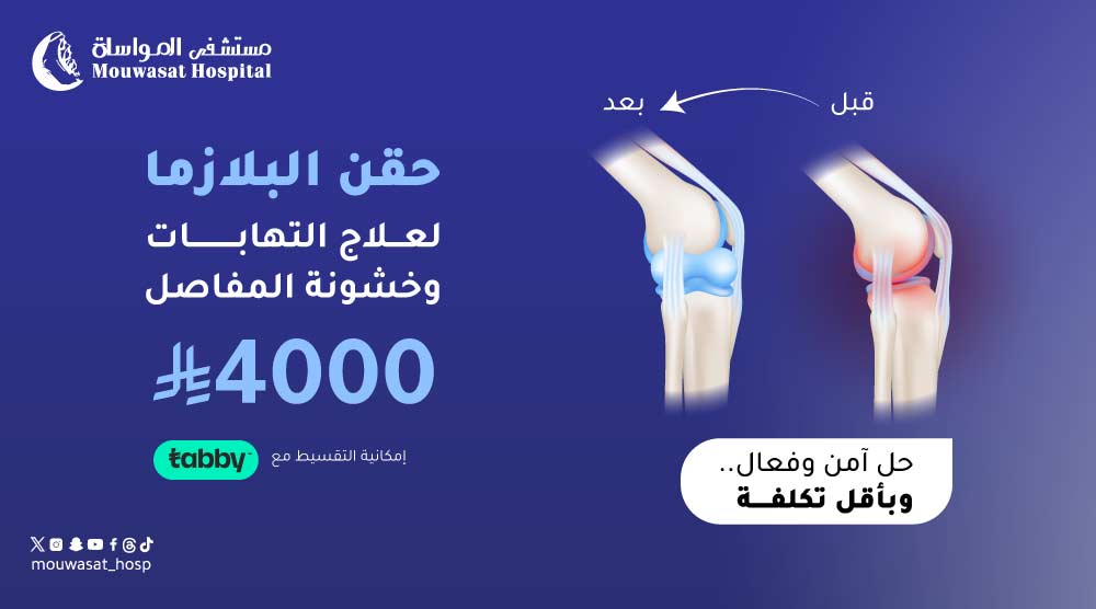 حقن المفاصل بالبلازما