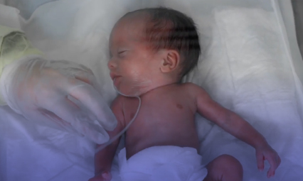  Pediatric - Early labour قصة نجاح ولادة طفل مبكرة