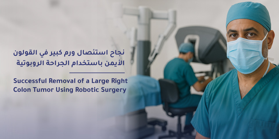 نجاح استئصال ورم كبير في القولون باستخدام الجراحة الروبوتية في مستشفى المواساة الخبر 