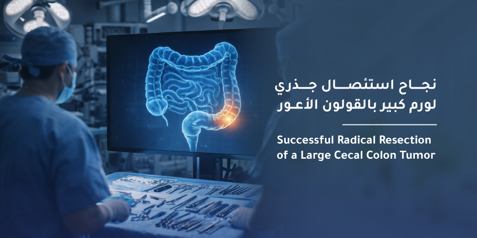 Successful Radical Resection of a Large Cecal Colon Tumor at Mouwasat Hospital in Madinah 