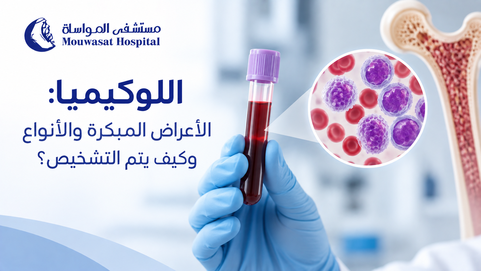 Leukemia: Early Symptoms, Types and How It Is Diagnosed