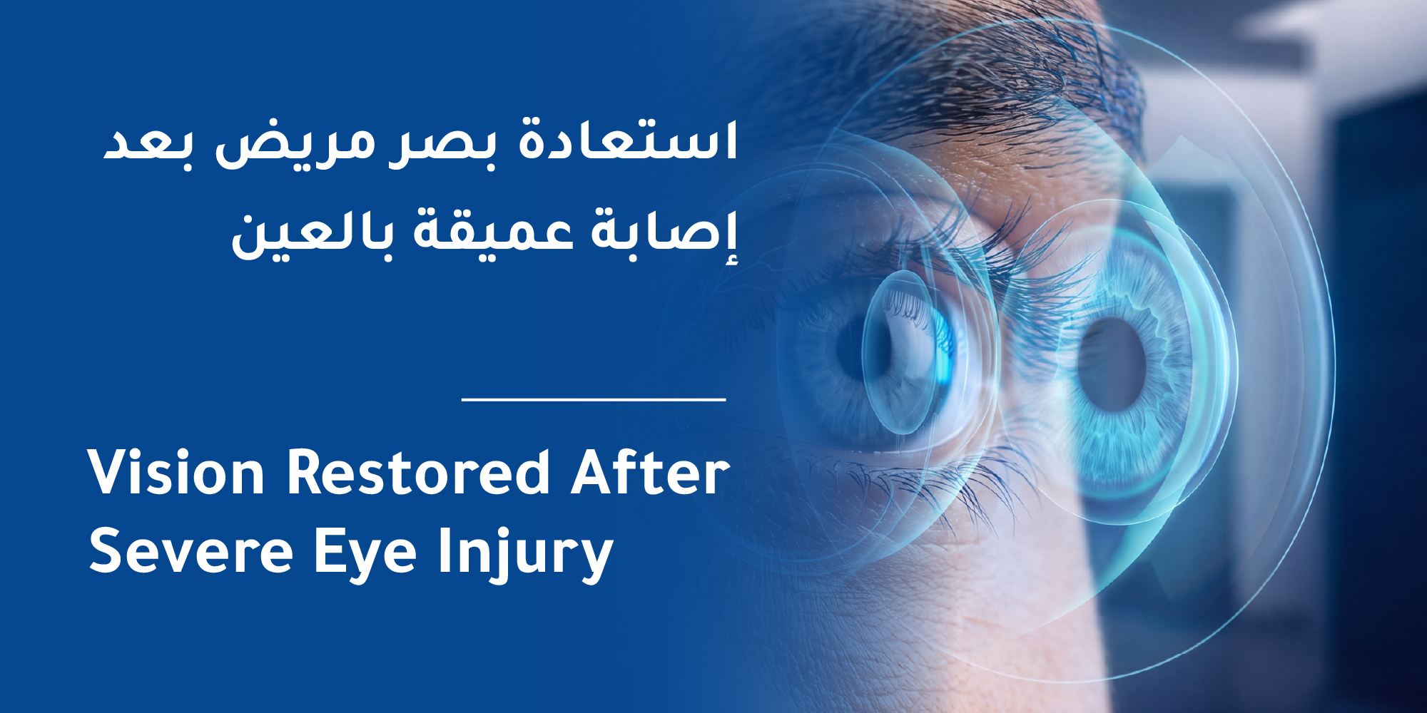 إنقاذ بصر مريض بعد إصابة عميقة بالعين في المواساة القطيف