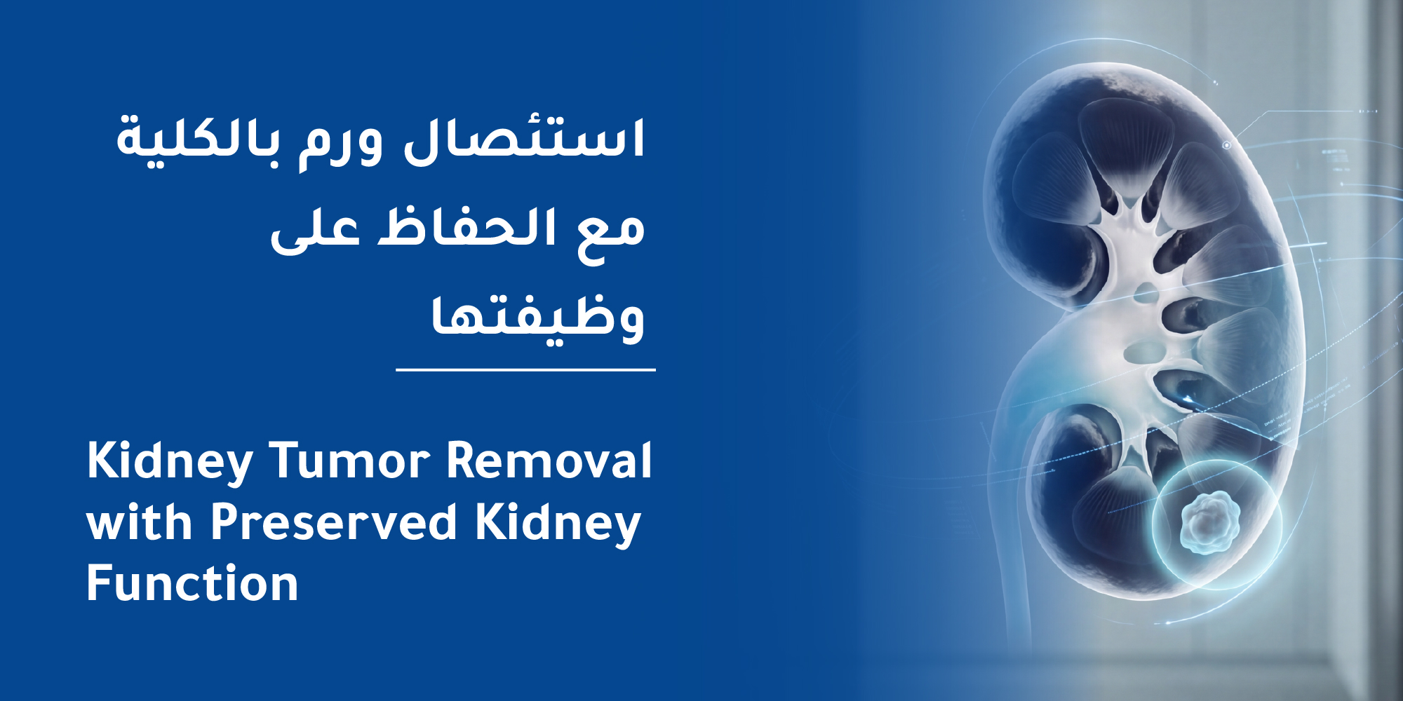 Partial Nephrectomy at Mouwasat Hospital Madinah