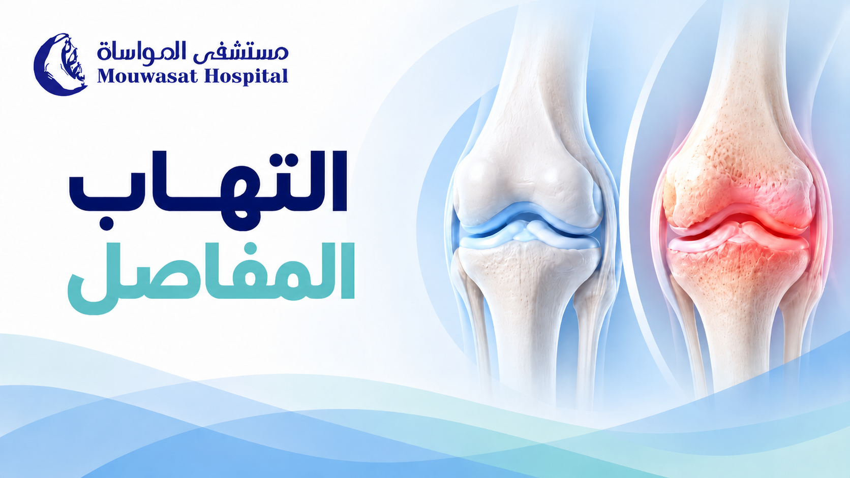 Arthritis Types &amp; Symptoms: Osteoarthritis vs RA