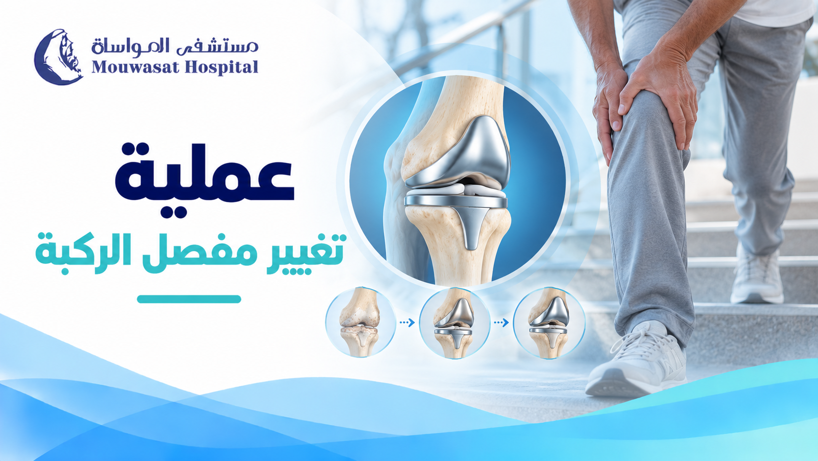عملية تغيير مفصل الركبة: متى تحتاجها وكيف يكون التعافي؟