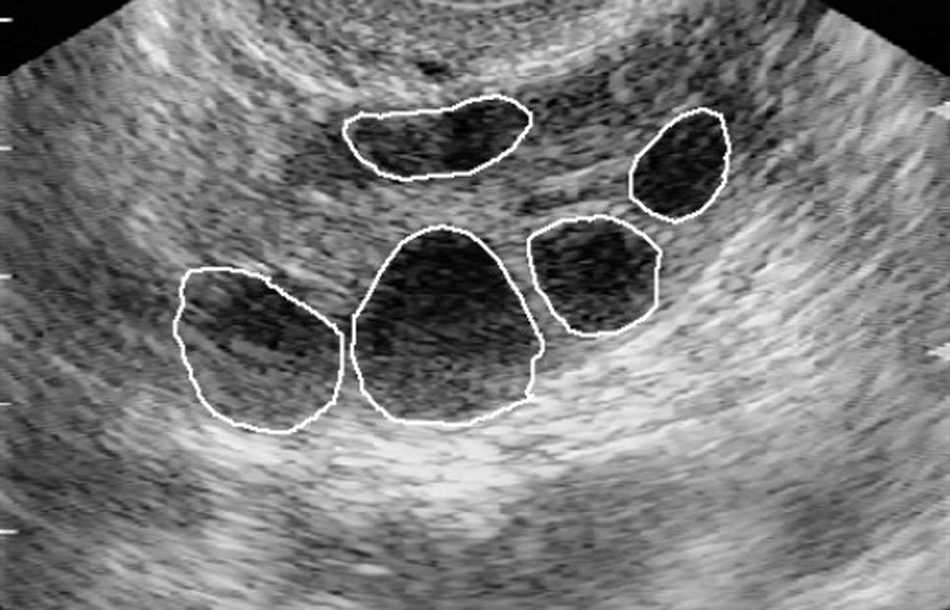 fertility.jpg