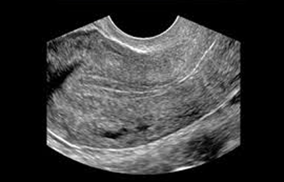 gynecological.jpg