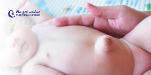 Umbilical Hernia in Children: Causes, Symptoms, and Treatment 